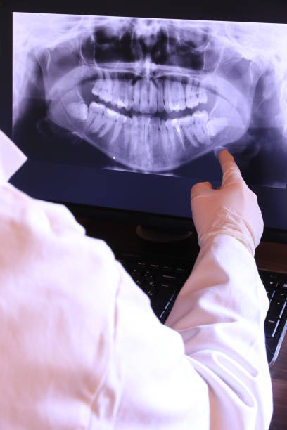 Best Emergency Dental Care for Broken or Chipped Teeth in Shields, MI